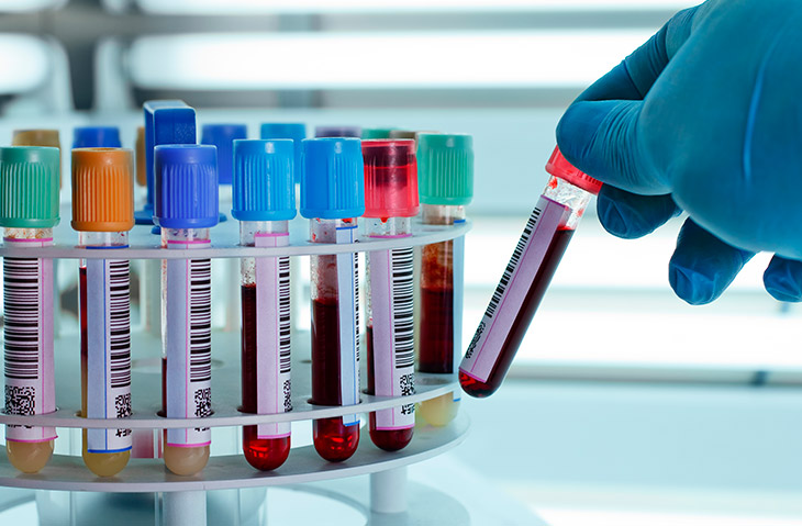 Quais são as principais vantagens da hematologia laboratorial para os pacientes?