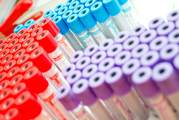 15 dicas para reduzir custos no seu laboratório