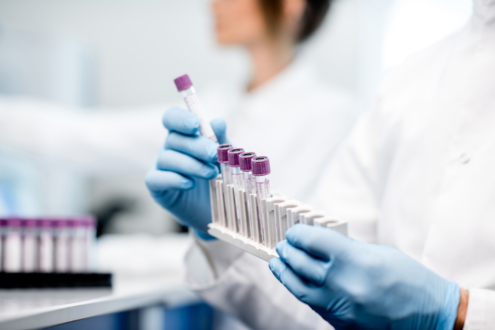 Como conseguir descontos com fornecedores de materiais para laboratório de análises clínicas?