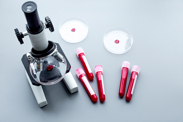 O que é controle de qualidade para laboratório de análises clínicas?