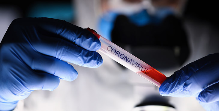 como-serao-os-laboratorios-de-analises-clinicas-apos-a-pandemia-do-novo-coronavirus