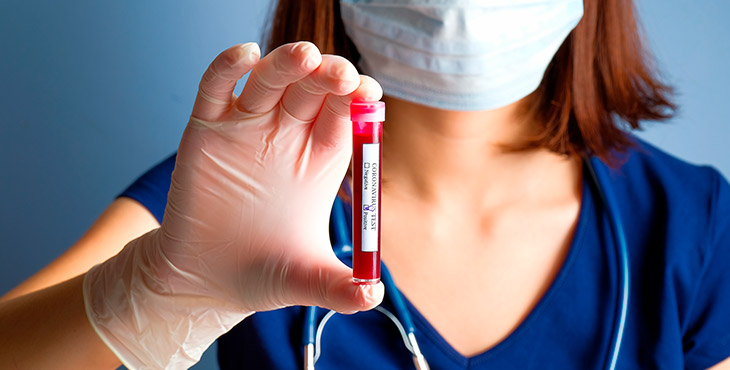 coronavirus-crise-e-gerenciamento-de-riscos-em-laboratorios-de-analises-clinicas