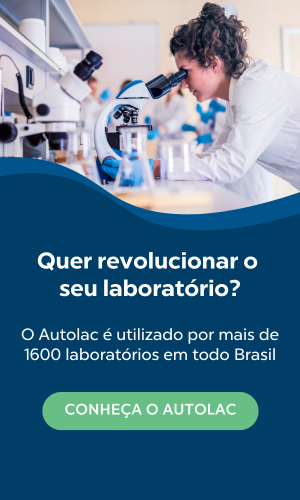 Banner Autolac PADRÃO | Lateral