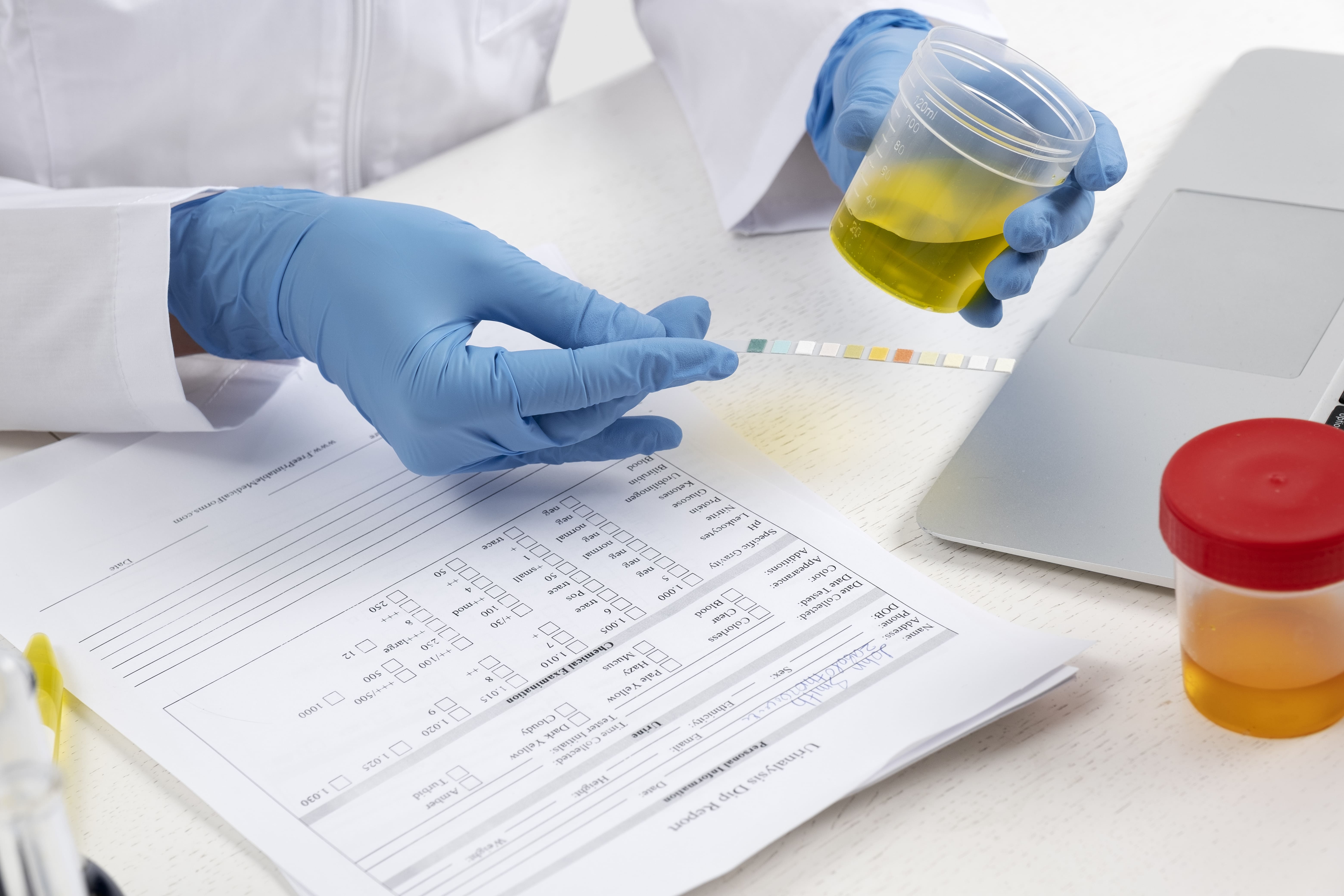 exames-toxicologicos